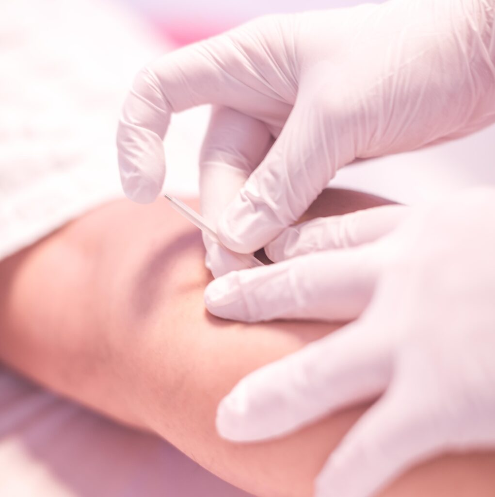 Kaukura fisioterapia