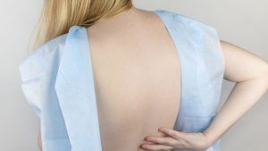 lordosis