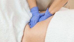 diastasis-3