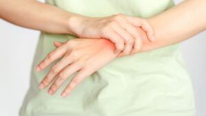 fractura-colles-2