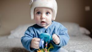 craneo-bebe-2