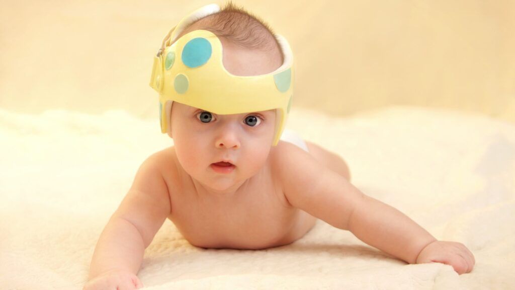 craneo-bebe-3