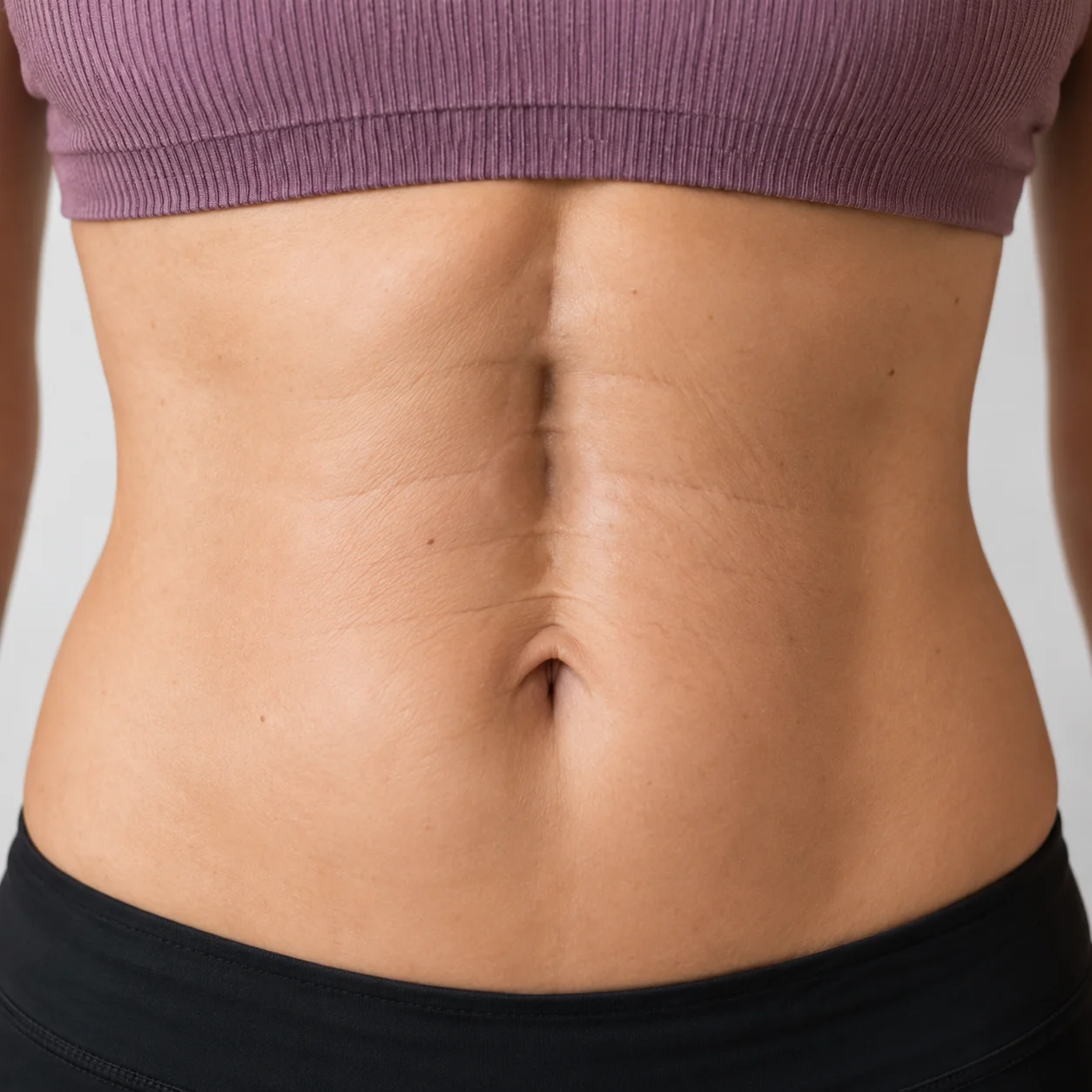 Diástasis abdominal